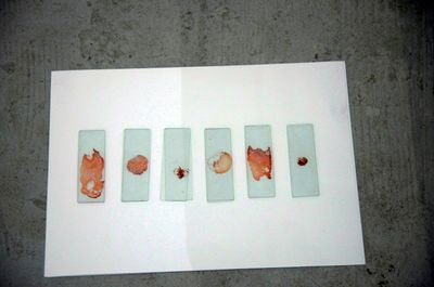 Slides of blood and fake blood